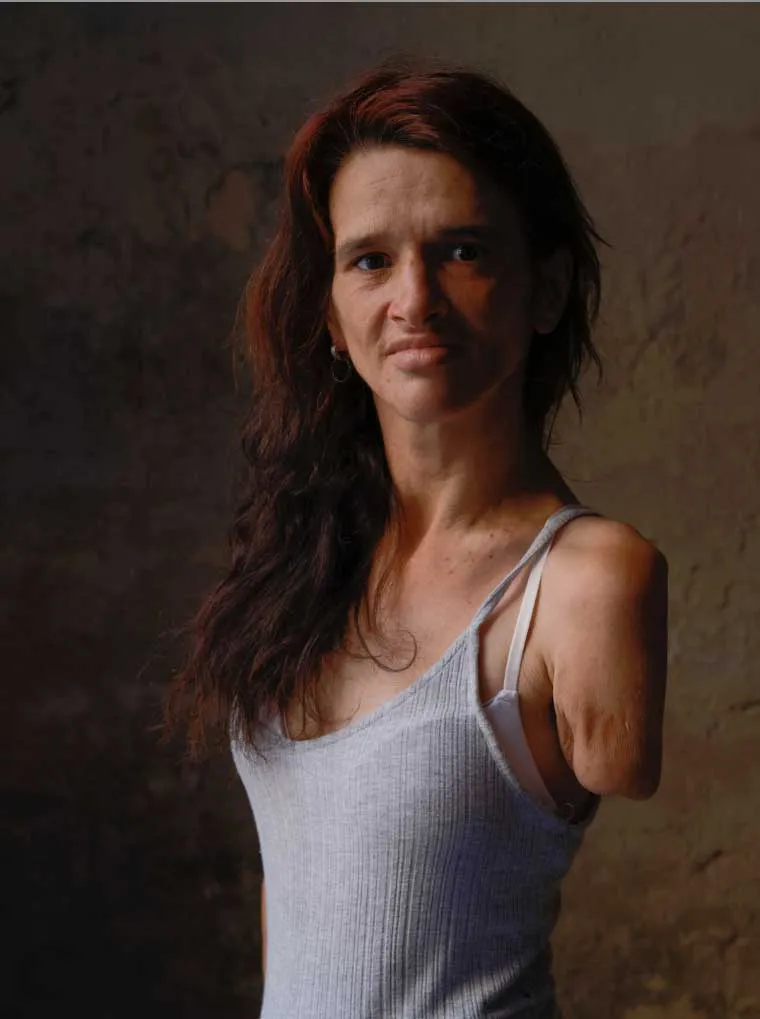 Retrato de plano medio de una mujer con cabello largo rojizo y camiseta de tirantes gris, mostrando sus brazos con amputación parcial bajo una luz lateral dramática.